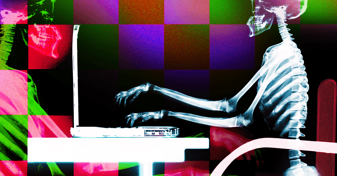 How to Prevent Tech Neck and Sit Properly With Your Laptop (2025) How to Prevent Tech Neck and Sit Properly With Your Laptop (2025)